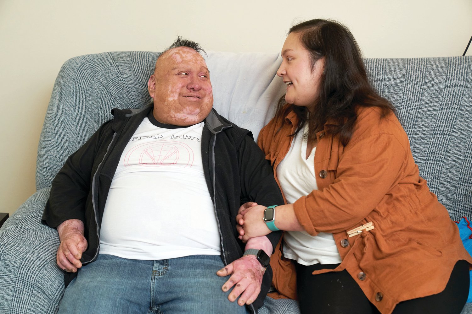 On Rare Disease Day, Armando Head-McCurdy and Sarah Morrill, of Bensalem, discuss life, love and how they manage Epidermolysis Bullosa.